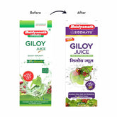 Baidyanath Asli Ayurved Giloy Juice Natural Immunity Booster, Help To Overcome Weakness After Long Illness | 1 Litre 2.2lbs